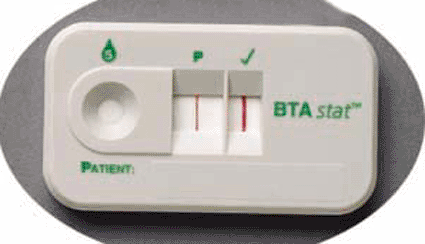 Image: The BTAstat test, designed for the early detection of bladder cancer (Photo courtesy of Polymedco).